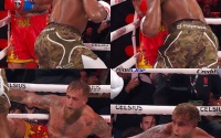 What are people saying about the Jake Paul vs Anthony Joshua result nakisa bidarian boxer cruiserweight broken jawbone surgery operation hospital bed