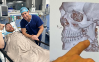 Claudio Squeo recovering in hospital from a badly broken jaw Claudio Squeo shares details of horrific injury from Jai Opetaia fight boxrec watch full highlights youtube manager mick francis