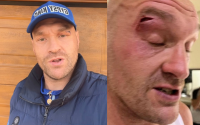 Tyson Fury nutritionist reveals george lockhart instagram website diet tips key ingredient to recover from cut in time for Oleksandr Usyk clash weight loss